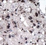 HK2 / Hexokinase 2 Antibody (aa401-431)