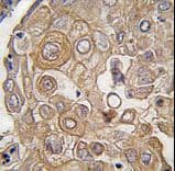 Polyclonal Rabbit anti-Human TLR6 Antibody (aa393-423, IHC, WB)