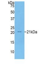 Human CD27 Protein (Recombinant His, N-Terminal)
