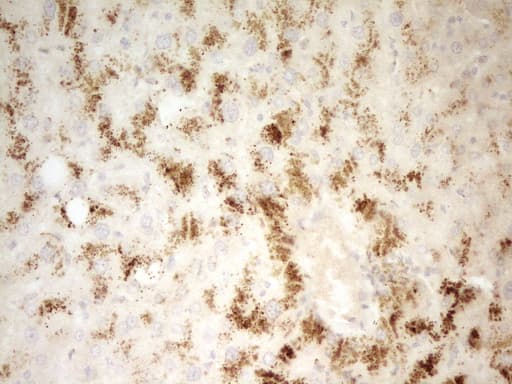 Monoclonal Mouse anti-Human PIK3R4 Antibody (clone OTI5D1, aa732-1036, IHC)