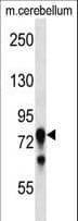 Polyclonal Rabbit anti-Mouse PRKCG / PKC-Gamma Antibody (aa74-102, WB)