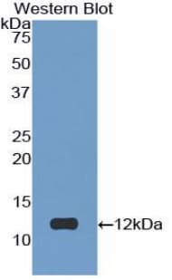 SST / Somatostatin Antibody (aa27-116, APC)