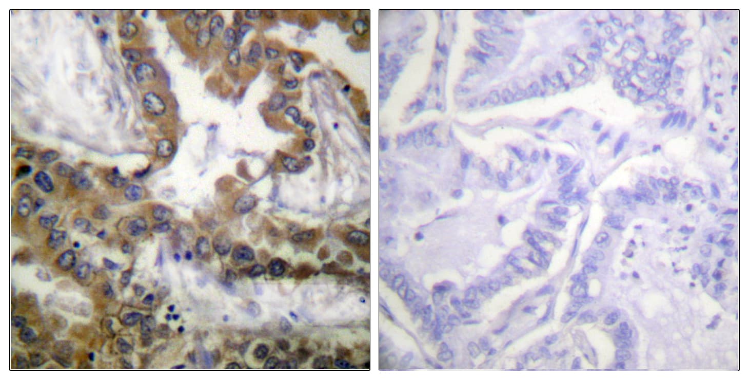 KDR / VEGFR2 / FLK1 Antibody (aa1020-1069)