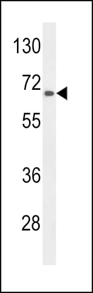 Polyclonal Rabbit anti-Human AGXT2 Antibody (aa437-463, WB)