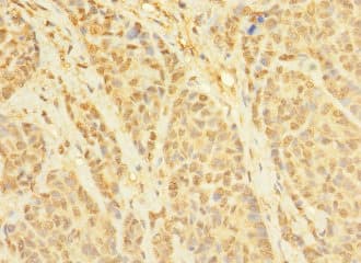 CCDC79 Antibody