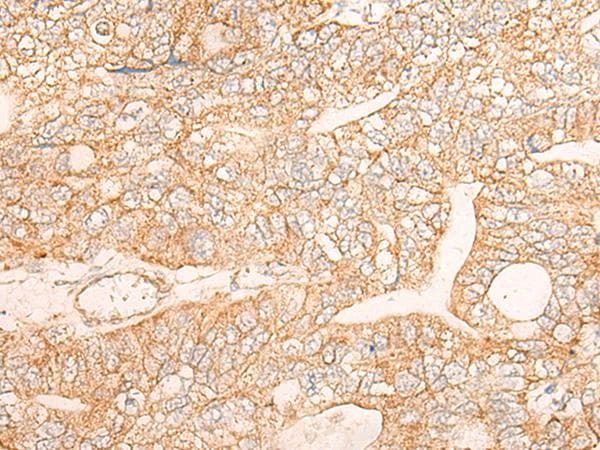 Polyclonal Rabbit anti-Human KRT9 / CK9 / Cytokeratin 9 Antibody (IHC)