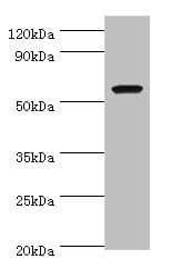 Polyclonal Rabbit anti-Human AMY1A / Salivary Amylase Antibody (aa16-200, WB)