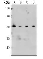 CAMK2A / CaMKII Alpha Antibody