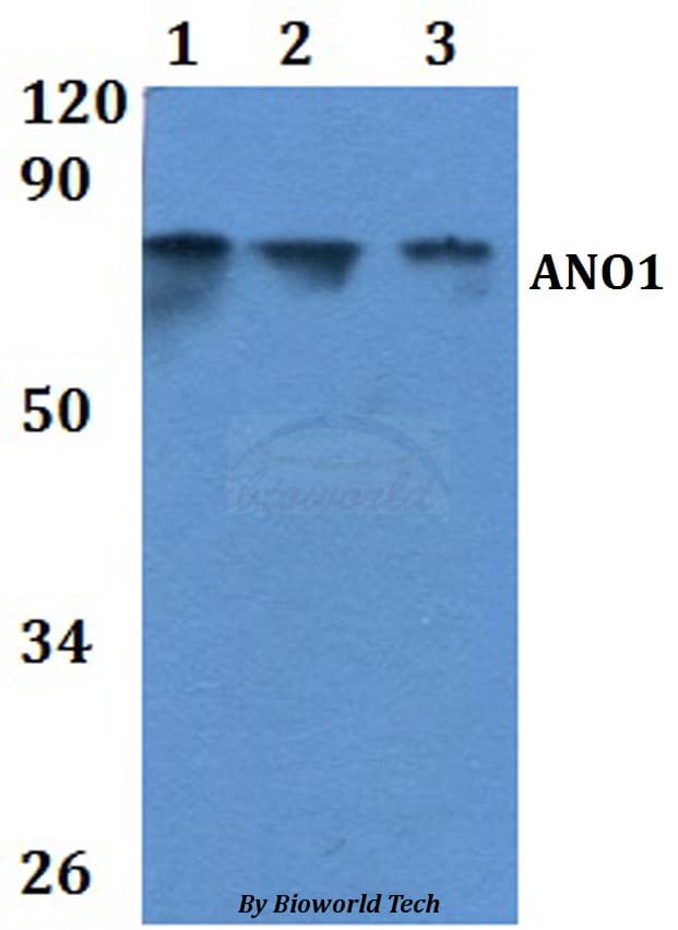 ANO1 / DOG1 / TMEM16A Antibody