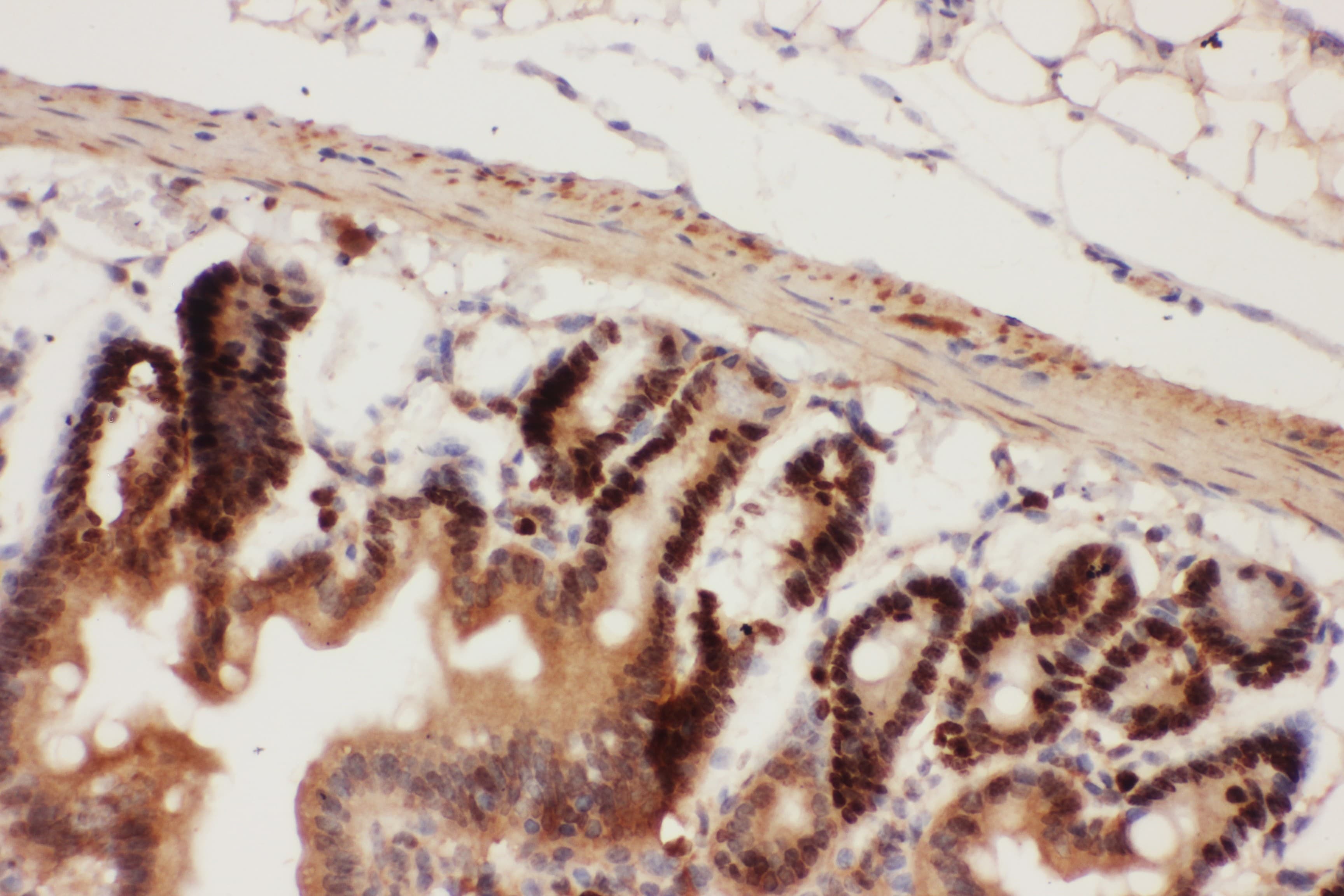 BECN1 / Beclin-1 Antibody (aa1-354)