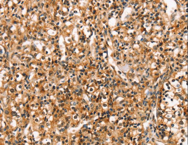 RGS1 Antibody