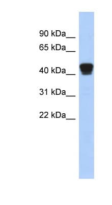 Polyclonal Rabbit anti-Human ERP44 Antibody (C-Terminus, WB)