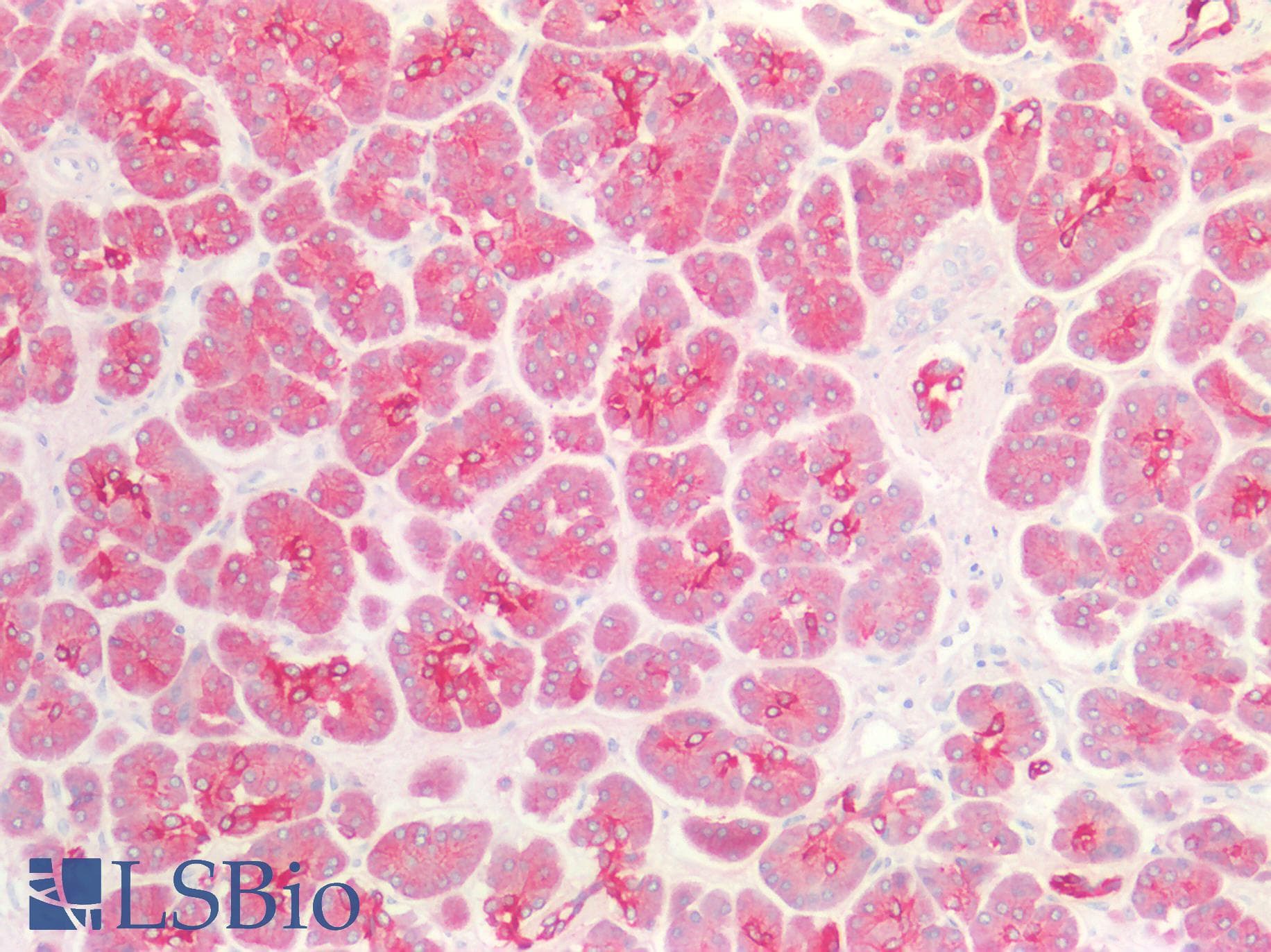PathPlus™ KRT18 / CK18 / Cytokeratin 18 Antibody