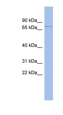 Polyclonal Rabbit anti-Human TP73 / p73 Antibody (aa287-336, WB)