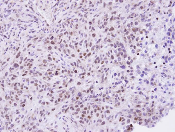 Polyclonal Rabbit anti-Human ZHX2 / RAF Antibody (aa533-826, IHC, WB)