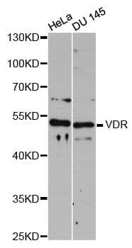 Vitamin D Receptor / VDR Antibody