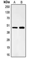 Polyclonal Rabbit anti-Human FOXB2 Antibody (Internal, WB)