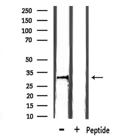 CD74 / CLIP Antibody