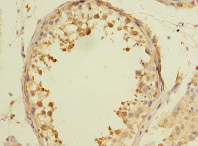 Polyclonal Rabbit anti-Human AARSD1 Antibody (IHC, WB)