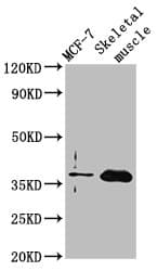 FBP2 Antibody