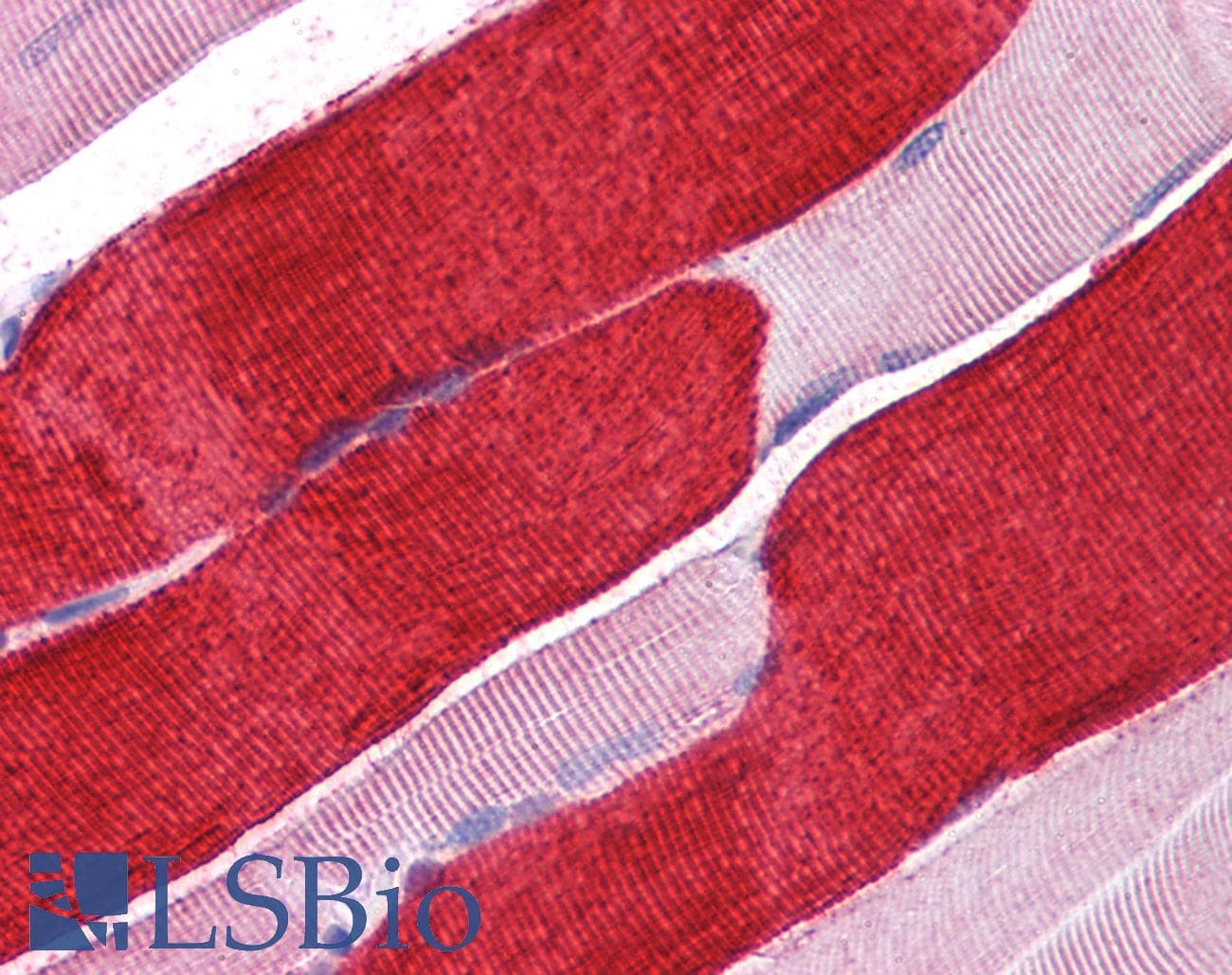 IHC-plus™ MYL3 Antibody (clone 3F8)