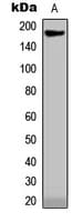 Endostatin Antibody (Internal)