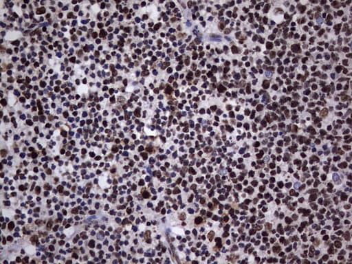 HNRNPL / hnRNP L Antibody (aa270-502, clone OTI9G7, Carrier-free)