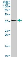 Monoclonal Mouse anti-Human ACAA1 Antibody (clone 3F11, IHC, WB)