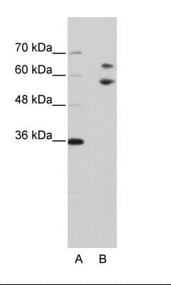 TROVE2 Antibody (aa20-69)