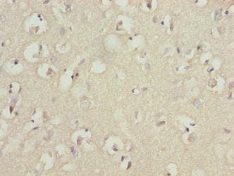 Polyclonal Rabbit anti-Human TUBB1 / Tubulin Beta 1 Antibody (IHC, WB)