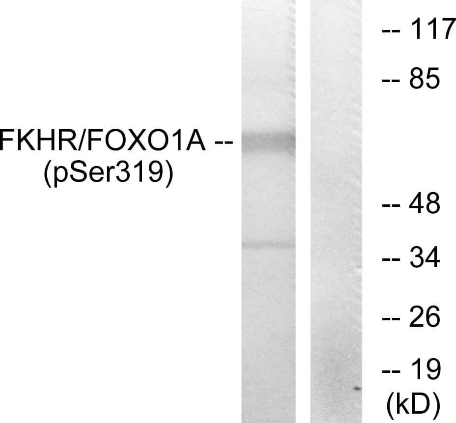 FOXO1 / FKHR Antibody (phospho-Ser319)