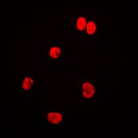 LMNA / Lamin A+C Antibody (Internal)
