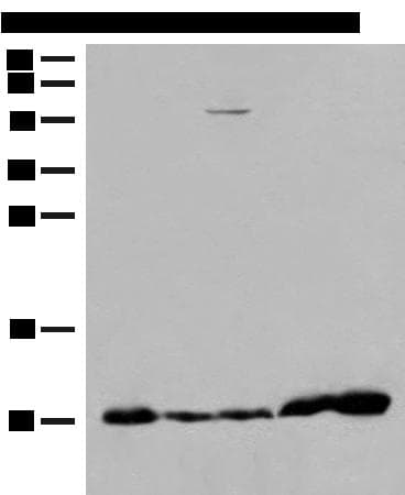 Polyclonal Rabbit anti-Human ATP5I Antibody (IHC, WB)