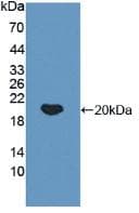 NFKBIA / IKB Alpha / IKBA Antibody (aa74-247)