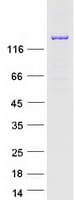 Human EPRS / PARS Protein (Recombinant Myc-DDK (Flag))