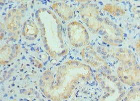 Polyclonal Rabbit anti-Human CUL5 / Cullin-5 Antibody (aa1-300, IHC)