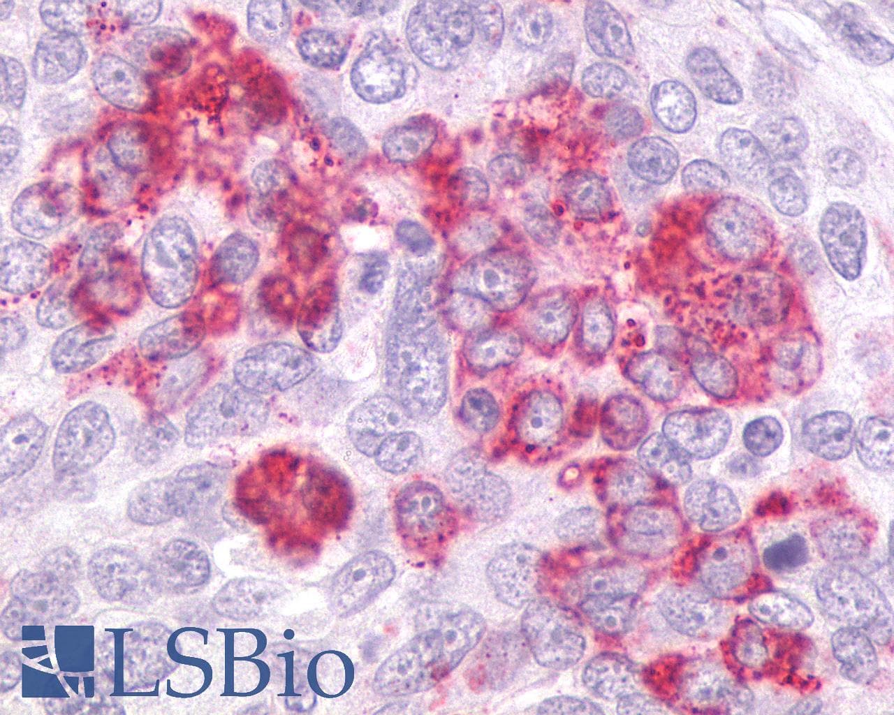 PathPlus™ Polyclonal Rabbit anti-Human GPR55 Antibody (Extracellular Domain, IHC)
