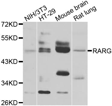 Polyclonal Rabbit anti-Human RARG / RAR-Gamma Antibody (IHC, IF, WB)
