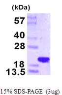Human NAA50 / NAT13 / SAN Protein (Recombinant His)