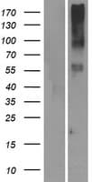 Human OR14I1 Protein (Over-Expression Lysate Myc-DDK (Flag))