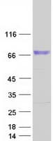 Human CDH23 / Cadherin 23 Protein (Recombinant Myc-DDK (Flag))