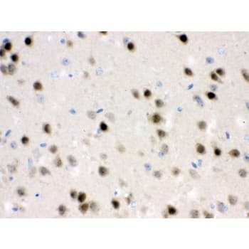HDAC11 Antibody (aa47-81)