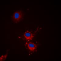 BCL2L1 / BCL-XL Antibody (phospho-Ser62)