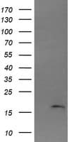 Monoclonal Mouse anti-Human CTAG1B / NY-ESO-1 Antibody (clone OTI1G9, IF, WB)