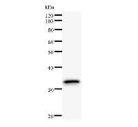 PAPD7 / TRF4-1 Antibody (clone 2794C4a)