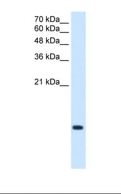 Polyclonal Rabbit anti-Human C3orf10 Antibody (C-Terminus, IHC, WB)