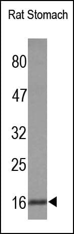 Gastric Inhibitory Peptide Antibody