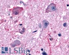 PathPlus™ Polyclonal Rabbit anti-Human MCHR1 Antibody (N-Terminus, IHC)