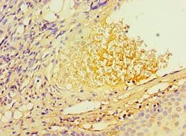 Polyclonal Rabbit anti-Human TERF2IP / RAP1 Antibody (aa1-280, IHC)