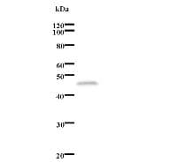ERCC6 / CSB Antibody (clone 553C5a)